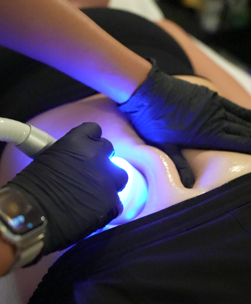 Body Contouring Image for Website.png