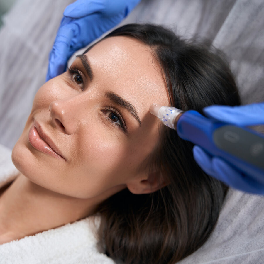 microneedling.jpg