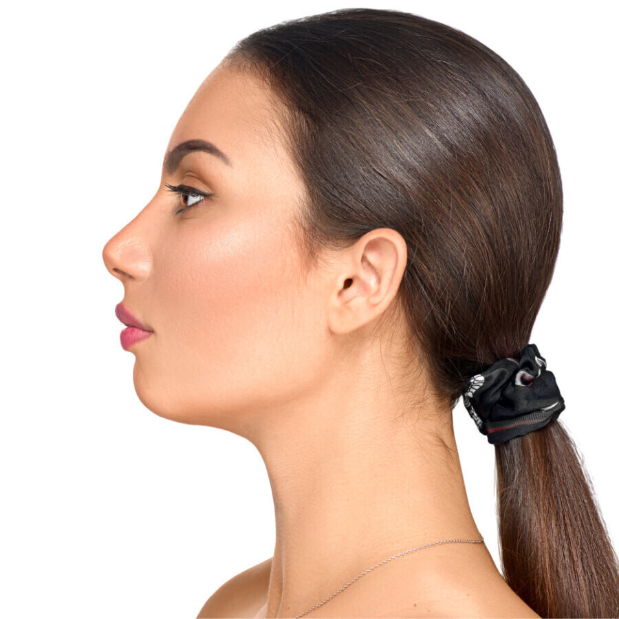 kybella.jpg